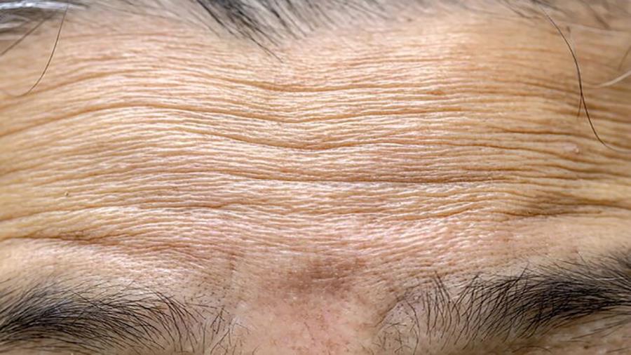 ترکیب فناوری نانو و زیست‌فناوری برای جوان‌سازی طبیعی